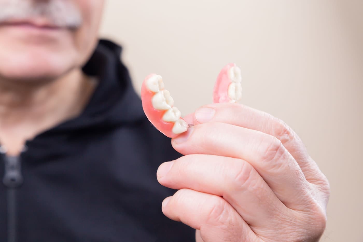 Full-Arch Implants vs. Dentures: Which Is Better Long-Term?