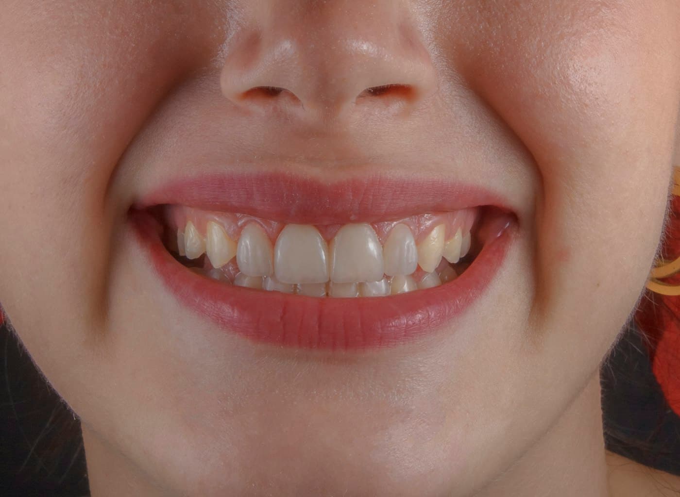 7 Everyday Habits That Are Secretly Damaging Your Teeth