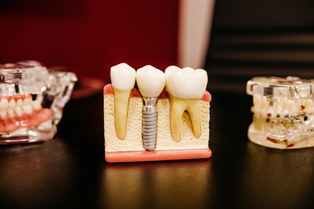 Dental Implants & Full-Arch
