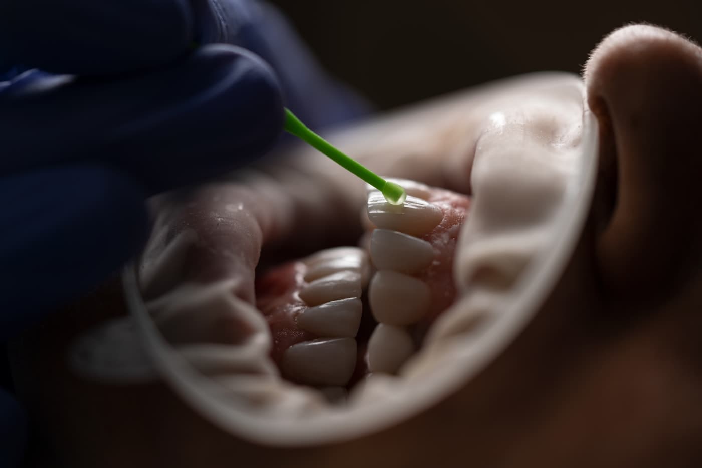 Dental Exam & Cleaning