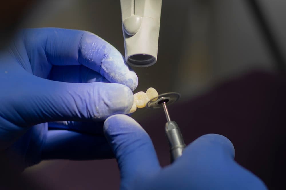 CEREC Same-Day Crown Technology